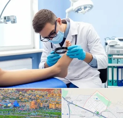 درمان زخم پای دیابتی در رشدیه تبریز 