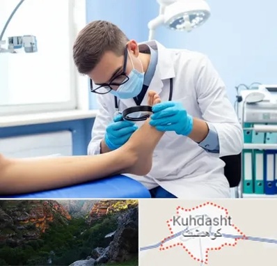 درمان زخم پای دیابتی در کوهدشت