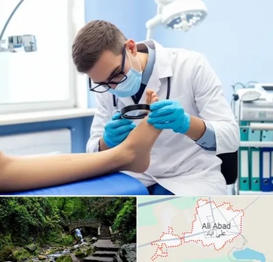 درمان زخم پای دیابتی در علی آباد کتول