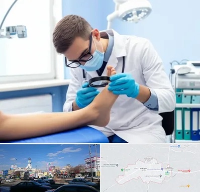 درمان زخم پای دیابتی در ماهدشت کرج 