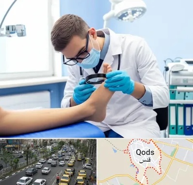 درمان زخم پای دیابتی در شهر قدس