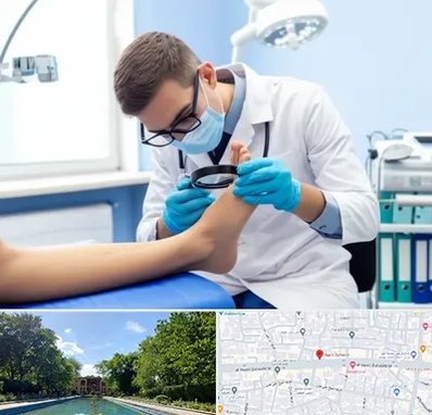 درمان زخم پای دیابتی در هشت بهشت اصفهان 