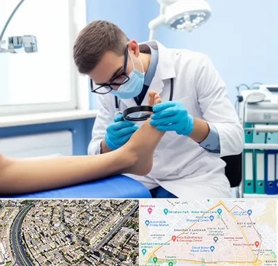 درمان زخم پای دیابتی در شهرک غرب مشهد 