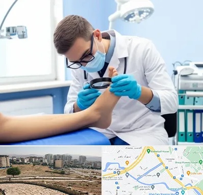 درمان زخم پای دیابتی در کوی وحدت شیراز 