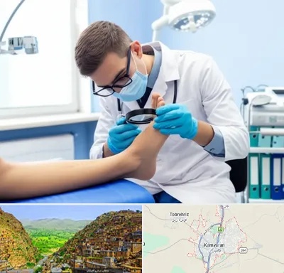 درمان زخم پای دیابتی در کامیاران