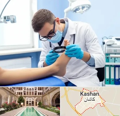 درمان زخم پای دیابتی در کاشان