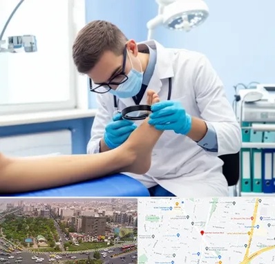 درمان زخم پای دیابتی در آیت الله کاشانی
