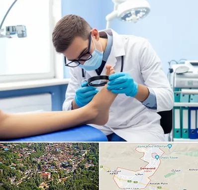 درمان زخم پای دیابتی در دماوند