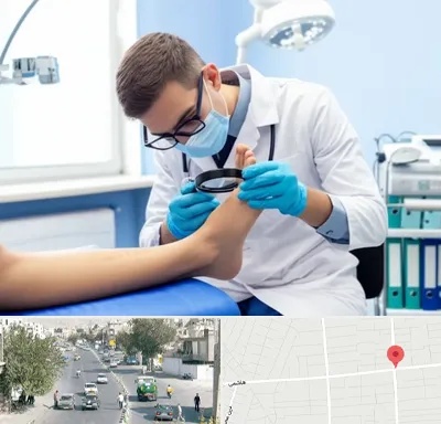 درمان زخم پای دیابتی در هاشمی