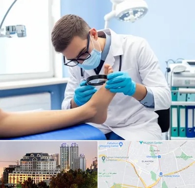 درمان زخم پای دیابتی در فرشته 