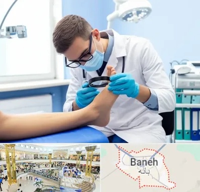 درمان زخم پای دیابتی در بانه