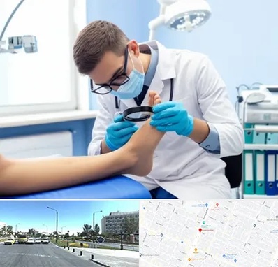درمان زخم پای دیابتی در بلوار کلاهدوز مشهد 