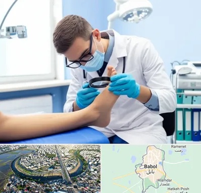 درمان زخم پای دیابتی در بابل