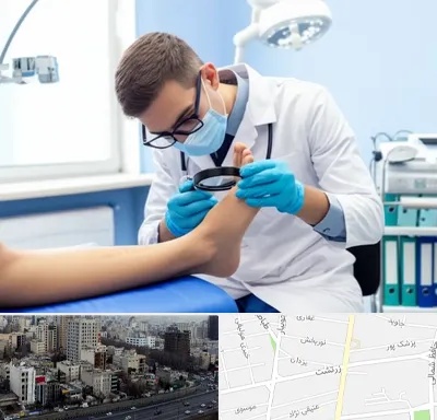 درمان زخم پای دیابتی در زرتشت