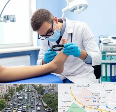 درمان زخم پای دیابتی در گلشهر کرج 