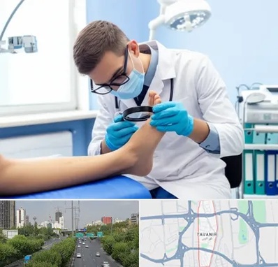 درمان زخم پای دیابتی در توانیر 