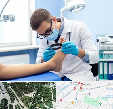 درمان زخم پای دیابتی در سالاریه قم 