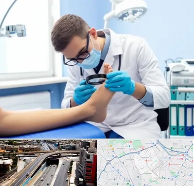 درمان زخم پای دیابتی در ستارخان شیراز