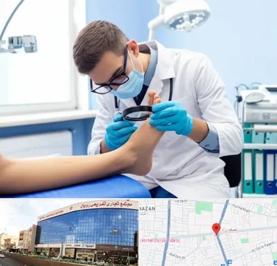 درمان زخم پای دیابتی در نصف راه تبریز 