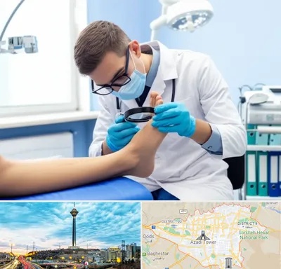 درمان زخم پای دیابتی در تهران