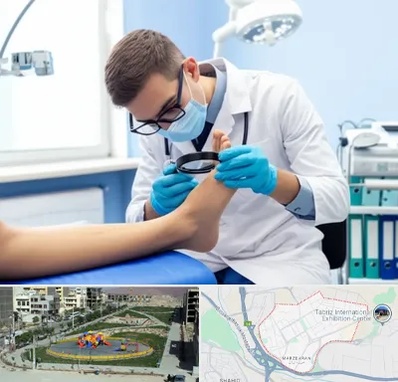 درمان زخم پای دیابتی در مرزداران تبریز 