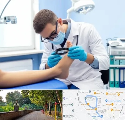 درمان زخم پای دیابتی در فلکه گاز رشت 