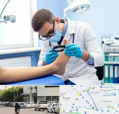 درمان زخم پای دیابتی در قدوسی شرقی شیراز 