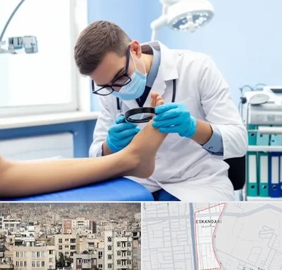 درمان زخم پای دیابتی در اسکندری
