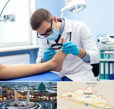درمان زخم پای دیابتی در زنجان