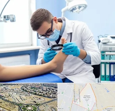 درمان زخم پای دیابتی در اندیشه