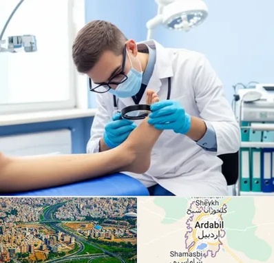 درمان زخم پای دیابتی در اردبیل