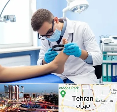 درمان زخم پای دیابتی در صادقیه 