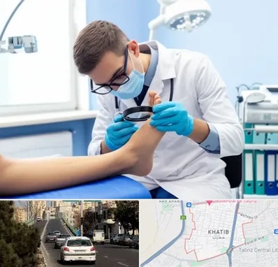 درمان زخم پای دیابتی در خطیب تبریز 