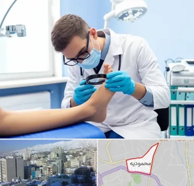 درمان زخم پای دیابتی در محمودیه
