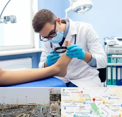 درمان زخم پای دیابتی در بلوار توس مشهد 