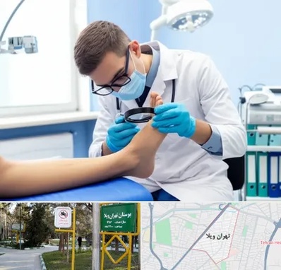 درمان زخم پای دیابتی در تهران ویلا