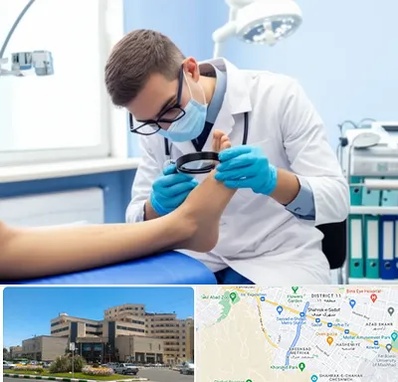 درمان زخم پای دیابتی در صیاد شیرازی مشهد 