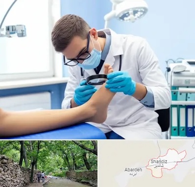 درمان زخم پای دیابتی در شاندیز مشهد 