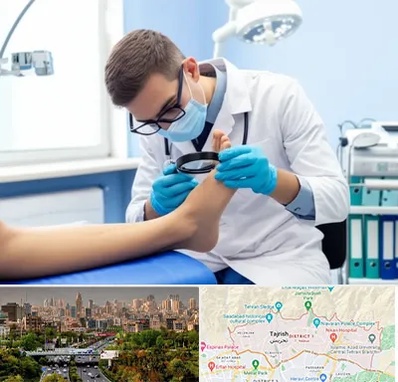 درمان زخم پای دیابتی در منطقه 1 تهران 