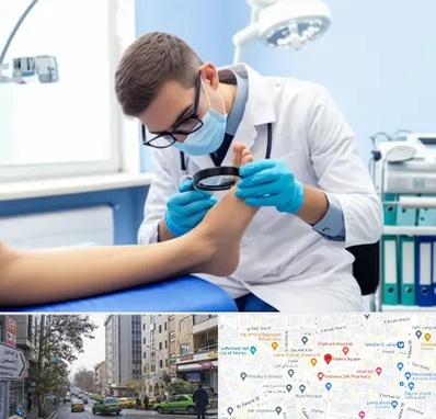 درمان زخم پای دیابتی در فاطمی