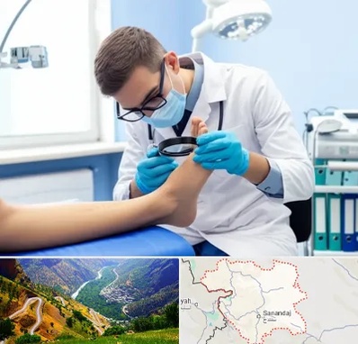 درمان زخم پای دیابتی در کردستان