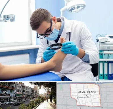 درمان زخم پای دیابتی در خیابان جمالزاده 