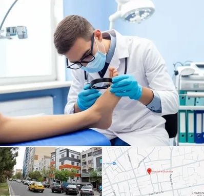 درمان زخم پای دیابتی در هفده شهریور تبریز 