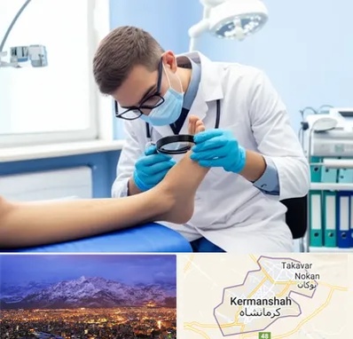 درمان زخم پای دیابتی در کرمانشاه