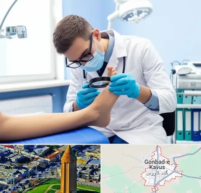 درمان زخم پای دیابتی در گنبد کاووس