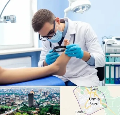 درمان زخم پای دیابتی در ارومیه