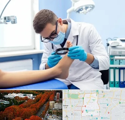 درمان زخم پای دیابتی در منطقه 6 تهران 