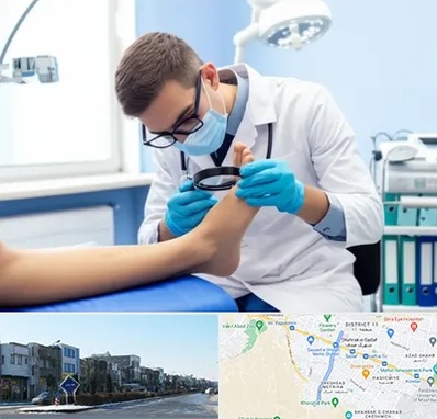 درمان زخم پای دیابتی در شریعتی مشهد 