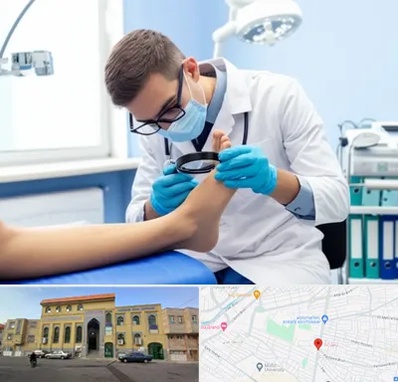 درمان زخم پای دیابتی در زنبیل آباد قم 