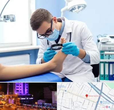 درمان زخم پای دیابتی در آبرسان تبریز 